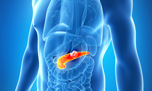 cancer pancreas
